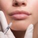 Facial fat grafting procedure