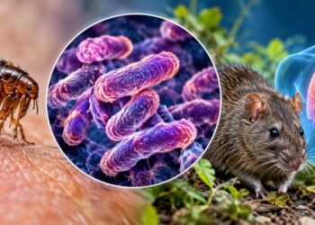 Plague: Causes, symptoms and treatment